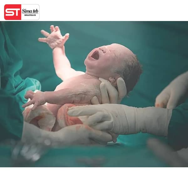 زایمان طبیعی یا سزارین زایمان طبیعی با اپیدورال عوارض زایمان سزارین عوارض زایمان طبیعی 