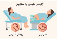 زایمان طبیعی یا سزارین زایمان طبیعی با اپیدورال عوارض زایمان سزارین عوارض زایمان طبیعی